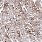 Immunohistochemical staining of human heart muscle shows moderate membranous positivity in cardiomyocytes.