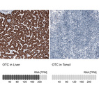 Anti-OTC Antibody