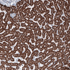 Immunohistochemical staining of human liver shows strong granular cytoplasmic positivity in hepatocytes.