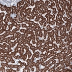 Immunohistochemical staining of human liver shows strong granular cytoplasmic positivity in hepatocytes.