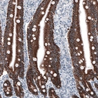 Immunohistochemical staining of human duodenum shows strong granular cytoplasmic positivity in glandular cells.