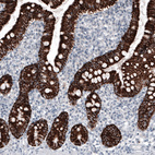 Immunohistochemical staining of human small intestine shows strong granular cytoplasmic positivity in glandular cells.