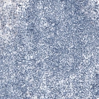 Immunohistochemical staining of human tonsil shows no positivity in lymphoid cells as expected.