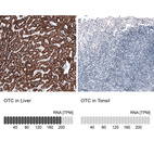 Anti-OTC Antibody