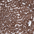 Immunohistochemical staining of human liver shows strong granular cytoplasmic positivity in hepatocytes.