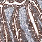 Immunohistochemical staining of human duodenum shows strong granular cytoplasmic positivity in glandular cells.