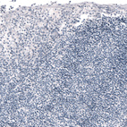 Immunohistochemical staining of human tonsil shows no positivity in non-germinal center cells as expected.