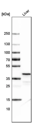 Western blot analysis in human liver tissue.