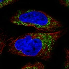 Immunofluorescence staining of RH-30 cells using the Anti-OTC monoclonal antibody, showing specific staining in mitochondria in green. Microtubule- and nuclear probes are visualized in red and blue, respectively (where available).
