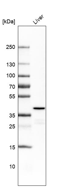 Anti-OTC Antibody