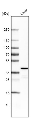 Anti-OTC Antibody