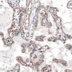 Anti-ADGRL4 Antibody