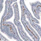 Anti-ADGRL4 Antibody