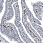 Immunohistochemical staining of human fallopian tube shows strong membranous positivity in endothelial cells.