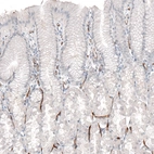 Immunohistochemical staining of human stomach shows strong membranous positivity in endothelial cells.