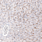 Anti-ADGRL4 Antibody