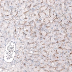 Immunohistochemical staining of human liver shows moderate positivity in liver sinusoids.