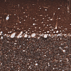 Immunohistochemical staining of human cerebellum shows strong positivity in neuropil.