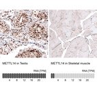 Anti-METTL14 Antibody