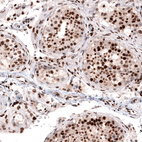 Immunohistochemical staining of human testis shows strong nuclear positivity in cells in seminiferous ducts.