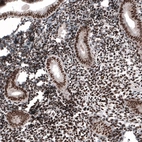 Immunohistochemical staining of human endometrium shows strong nuclear positivity in glandular and stromal cells.