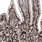Immunohistochemical staining of human duodenum shows strong nuclear positivity in glandular cells.