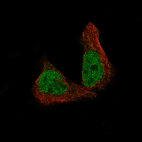 Immunofluorescence staining of RH-30 cells using the Anti-METTL14 monoclonal antibody, showing specific staining in the nucleoplasm in green. Microtubule- and nuclear probes are visualized in red and blue, respectively (where available).