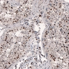 Immunohistochemical staining of human testis shows nuclear positivity in cells in seminiferous tubules.