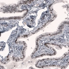 Immunohistochemical staining of human fallopian tube shows nuclear immunoreactivity in glandular cells.