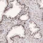 Anti-METTL14 Antibody