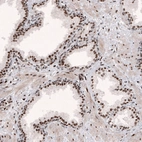 Immunohistochemical staining of human prostate shows strong nuclear positivity in glandular cells and in smooth muscle cells.