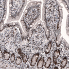 Anti-METTL14 Antibody