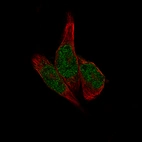Immunofluorescence staining of RH-30 cells using the Anti-METTL14 monoclonal antibody, showing specific staining in the nucleoplasm in green. Microtubule- and nuclear probes are visualized in red and blue, respectively (where available).