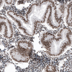 Immunohistochemical staining of human endometrium shows nuclear immunoreactivity in glandular cells.