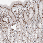 Immunohistochemical staining of human stomach shows nuclear immunoreactivity in glandular cells.