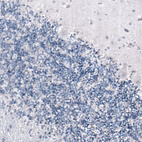 Anti-SMCHD1 Antibody