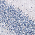 Immunohistochemical staining of human cerebellum shows no positivity as expected (negative control).