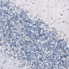 Immunohistochemical staining of human cerebellum shows no positivity as expected (negative control).