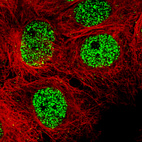 Immunofluorescence staining of A-431 cells using the Anti-SMCHD1 monoclonal antibody, showing specific staining in the nucleoplasm in green. Microtubule- and nuclear probes are visualized in red and blue, respectively (where available).