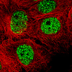 Anti-SMCHD1 Antibody