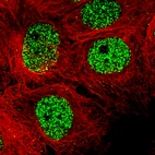 Immunofluorescence staining of A-431 cells using the Anti-SMCHD1 monoclonal antibody, showing specific staining in the nucleoplasm in green. Microtubule- and nuclear probes are visualized in red and blue, respectively (where available).