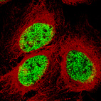 Immunofluorescence staining of U-2 OS cells using the Anti-SMCHD1 monoclonal antibody, showing specific staining in the nucleoplasm in green. Microtubule- and nuclear probes are visualized in red and blue, respectively (where available).