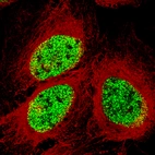 Immunofluorescence staining of U-2 OS cells using the Anti-SMCHD1 monoclonal antibody, showing specific staining in the nucleoplasm in green. Microtubule- and nuclear probes are visualized in red and blue, respectively (where available).