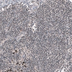 Immunohistochemical staining of human lymph node shows weak to moderate nuclear immunoreactivity in lymphoid cells.