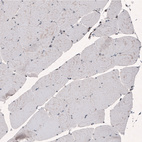 Immunohistochemical staining of human skeletal muscle shows no positivity as expected (negative control).
