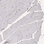 Immunohistochemical staining of human skeletal muscle shows no positivity as expected (negative control).