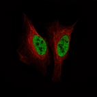 Immunofluorescence staining of U-2 OS cells using the Anti-SMCHD1 monoclonal antibody, showing specific staining in the nucleoplasm in green. Microtubule- and nuclear probes are visualized in red and blue, respectively (where available).