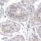 Immunohistochemical staining of human testis shows weak nuclear positivity in a subset of cells in seminiferous ducts.