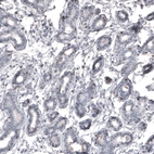 Immunohistochemical staining of human breast shows moderate nuclear positivity in a subset of glandular cells.