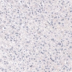 Immunohistochemical staining of human liver shows no positivity in hepatocytes as expected.